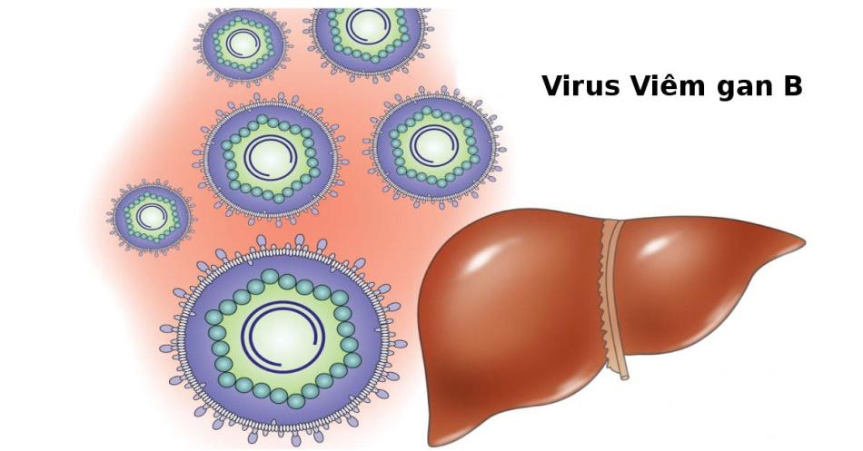 Viêm gan B: Nguyên nhân, triệu chứng và mức độ nguy hiểm. Xem ngay để biết!